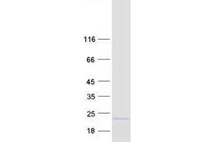 Western Blotting (WB) image for ASF1 Anti-Silencing Function 1 Homolog B (ASF1B) protein (Myc-DYKDDDDK Tag) (ABIN2714978)