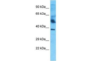Host:  Rabbit  Target Name:  HPR  Sample Type:  Thymus Tumor lysates  Antibody Dilution:  1. (HPR 抗体  (C-Term))