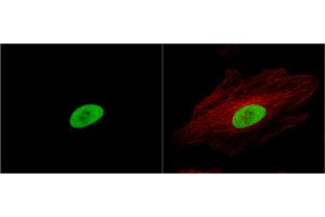 ICC/IF Image Ku80 antibody [N3C2], Internal detects Ku80 protein at nucleus by immunofluorescent analysis. (X-Ray Repair Cross Complementing 5 抗体)