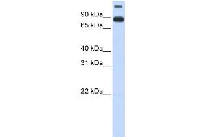 WB Suggested Anti-TMEM48 Antibody Titration:  0. (TMEM48 抗体  (Middle Region))