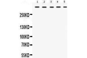 Western blot analysis of TRIO expression in rat cardiac muscle extract (lane 1), rat skeletal muscle extract (lane 2), mouse cardiac muscle extract (lane 3), mouse skeletal muscle extract (lane 4) and HELA whole cell lysates (lane 5). (TRIO 抗体  (C-Term))