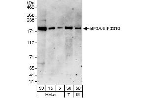 Western Blotting (WB) image for anti-Eukaryotic Translation Initiation Factor 3 Subunit A (EIF3A) (AA 1-50) antibody (ABIN7451755)
