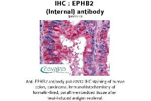 Image no. 1 for anti-EPH Receptor B2 (EPHB2) (Internal Region) antibody (ABIN1734081) (EPH Receptor B2 抗体  (Internal Region))