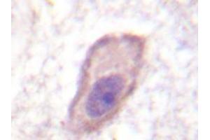 Immunohistochemistry analyzes of IFNGRA antibody in paraffin-embedded human brain tissue. (IFNGR1 抗体)