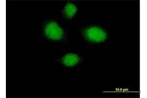 Immunofluorescence of purified MaxPab antibody to HSH2D on HeLa cell. (HSH2D 抗体  (AA 1-352))