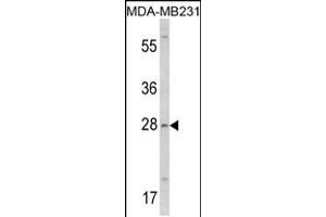 Western blot analysis of COLEC11 Antibody in MDA-MB231 cell line lysates (35ug/lane) (COLEC11 抗体  (N-Term))