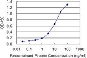 Detection limit for recombinant GST tagged XPR1 is 0. (xpr1 抗体  (AA 598-695))
