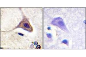 Immunohistochemistry analysis of paraffin-embedded human brain, using Opioid Receptor-delta (Phospho-Ser363) Antibody. (OPRD1 抗体  (pSer363))