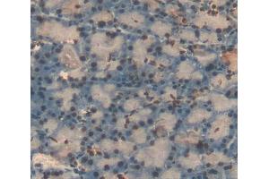 Used in DAB staining on fromalin fixed paraffin- embedded pancreas tissue (NR5A2 + LRH1 抗体  (AA 1-205))