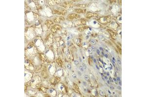 Immunohistochemistry of paraffin-embedded human esophageal using MYO1C antibody at dilution of 1:100 (x40 lens). (Myosin IC 抗体)
