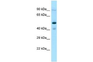 Host: Rabbit Target Name: OSGEPL1 Sample Type: Jurkat Whole Cell lysates Antibody Dilution: 1. (OSGEPL1 抗体  (C-Term))
