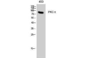 Western Blotting (WB) image for anti-Protein Kinase C, epsilon (PRKCE) (Thr308) antibody (ABIN3176925) (PKC epsilon 抗体  (Thr308))