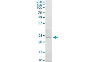 ATG5 monoclonal antibody (M06), clone 3G11. (ATG5 抗体  (AA 176-275))