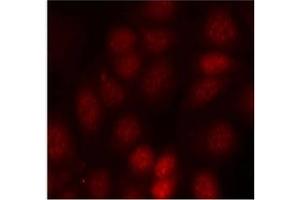 Image no. 3 for anti-Ribosomal Protein S6 Kinase, 70kDa, Polypeptide 1 (RPS6KB1) (pThr421) antibody (ABIN197014) (RPS6KB1 抗体  (pThr421))