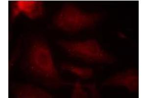 Image no. 2 for anti-Microtubule-Associated Protein tau (MAPT) (pSer404) antibody (ABIN196811) (MAPT 抗体  (pSer404))