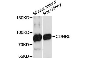 Western blot analysis of extracts of various cell lines, using CDHR5 antibody (ABIN6292199) at 1:3000 dilution. (CDHR5 抗体)