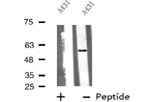 Western blot analysis of Cytochrome P450 51A1 using A431 whole cell lysates (CYP51A1 抗体  (Internal Region))