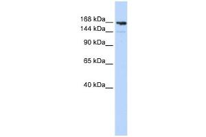 Periplakin antibody used at 1 ug/ml to detect target protein. (PPL 抗体  (Middle Region))