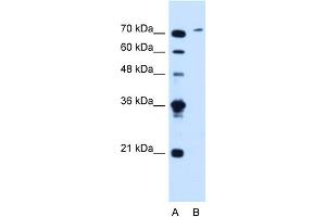 WB Suggested Anti-SLCO6A1 Antibody Titration:  1. (SLCO6A1 抗体  (C-Term))