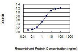 Detection limit for recombinant GST tagged MAGEA5 is 0. (MAGEA5 抗体  (AA 60-124))