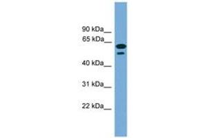 Image no. 1 for anti-Chromosome 19 Open Reading Frame 45 (C19ORF45) (AA 215-264) antibody (ABIN6746428) (C19ORF45 抗体  (AA 215-264))