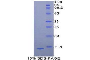SDS-PAGE (SDS) image for Plasminogen Activator, Urokinase Receptor (PLAUR) (AA 13-114) protein (His tag) (ABIN1080533) (PLAUR Protein (AA 13-114) (His tag))