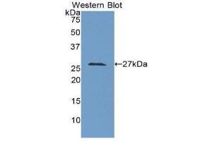Western Blotting (WB) image for anti-Lysyl Oxidase-Like 3 (LOXL3) (AA 509-712) antibody (ABIN1859688)