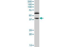 RING1 monoclonal antibody (M03), clone 2B3. (RING1 抗体  (AA 81-170))