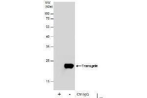 Immunoprecipitation (IP) image for anti-Transgelin (TAGLN) antibody (ABIN2855103)