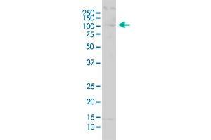 USP51 polyclonal antibody (A01). (USP51 抗体  (AA 261-337))