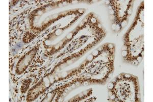 Immunoperoxidase of monoclonal antibody to YY1 on formalin-fixed paraffin-embedded human small Intestine. (YY1 抗体  (AA 221-320))