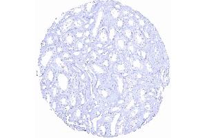 Kidney medulla (Recombinant Prostate Specific Antigen 抗体  (AA 150-250))