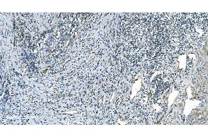IHC analysis of H Cadherin/CDH13 using anti-H Cadherin/CDH13 antibody (ABIN7600095). (Cadherin 13 抗体  (AA 149-692))