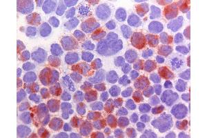 Immunohistochemistry (IHC) image for anti-ATP-Binding Cassette, Sub-Family C (CFTR/MRP), Member 10 (ABCC10) antibody (ABIN920696) (ABCC10 抗体)