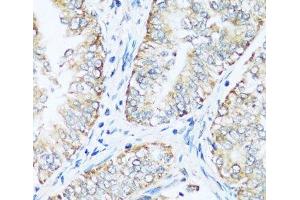 Immunohistochemistry (Paraffin-embedded Sections) (IHC (p)) image for anti-ATP Synthase, H+ Transporting, Mitochondrial F0 Complex, Subunit E (ATP5I) antibody (ABIN7259374)