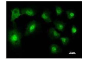 Immunostaining analysis in HT1080 cells. (NARS 抗体)