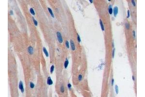 Immunohistochemistry (IHC) image for anti-CD274 (PD-L1) (AA 34-241) antibody (ABIN7443125)