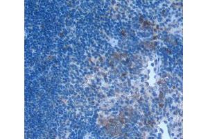 IHC-P analysis of Human Tissue, with DAB staining. (CCL3 抗体  (AA 27-92))