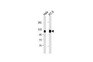 All lanes : Anti-TRIM28 Antibody (N-term) at 1:1000 dilution Lane 1: Hela whole cell lysate Lane 2: PC-3 whole cell lysate Lysates/proteins at 20 μg per lane.