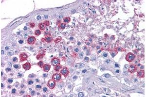Human Testis: Formalin-Fixed, Paraffin-Embedded (FFPE) (ATP11A 抗体  (N-Term))