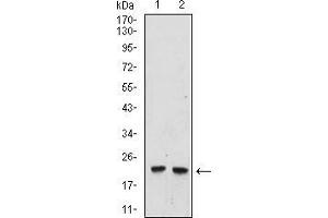 Western blot analysis using UBE2C mouse mAb against Hela (1), and Raji (2) cell lysate. (UBE2C 抗体  (AA 1-179))
