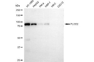 Western blotting analysis using PLOD2 antibody (ABIN7799903). (PLOD2 抗体)