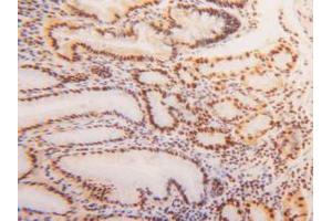 IHC-P analysis of Human Stomach Tissue, with DAB staining. (HNRNPA2B1 抗体  (AA 21-103))