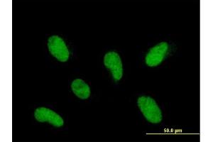 Immunofluorescence of purified MaxPab antibody to INTS12 on HepG2 cell. (INTS12 抗体  (AA 1-462))