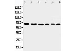 Anti-AIF antibody, Western blotting Lane 1: Rat Heart Tissue Lysate Lane 2: Rat Brain Tissue Lysate Lane 3: K562 Cell Lysate Lane 4: HEPG2 Cell Lysate Lane 5: A431 Cell Lysate Lane 6: NIH3T3 Cell Lysate