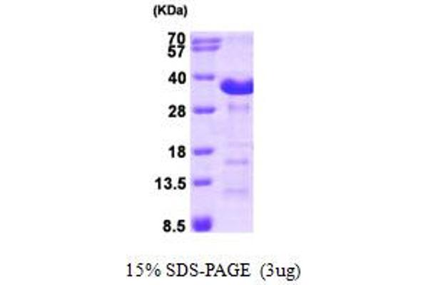 Aspartate beta Hydroxylase Protein (AA 75-270) (His tag)