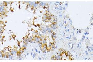Immunohistochemistry of paraffin-embedded Rat lung using EIF2B2 Polyclonal Antibody at dilution of 1:100 (40x lens). (EIF2B2 抗体)