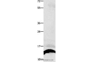 Western blot analysis of Human liver cancer tissue , using COX5B Polyclonal Antibody at dilution of 1:250 (COX5B 抗体)