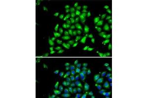 Immunofluorescence analysis of MCF7 cells using ARFGAP1 Polyclonal Antibody (ARFGAP1 抗体)
