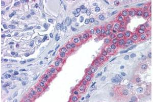 Human Kidney: Formalin-Fixed, Paraffin-Embedded (FFPE) (FAM33A 抗体  (N-Term))